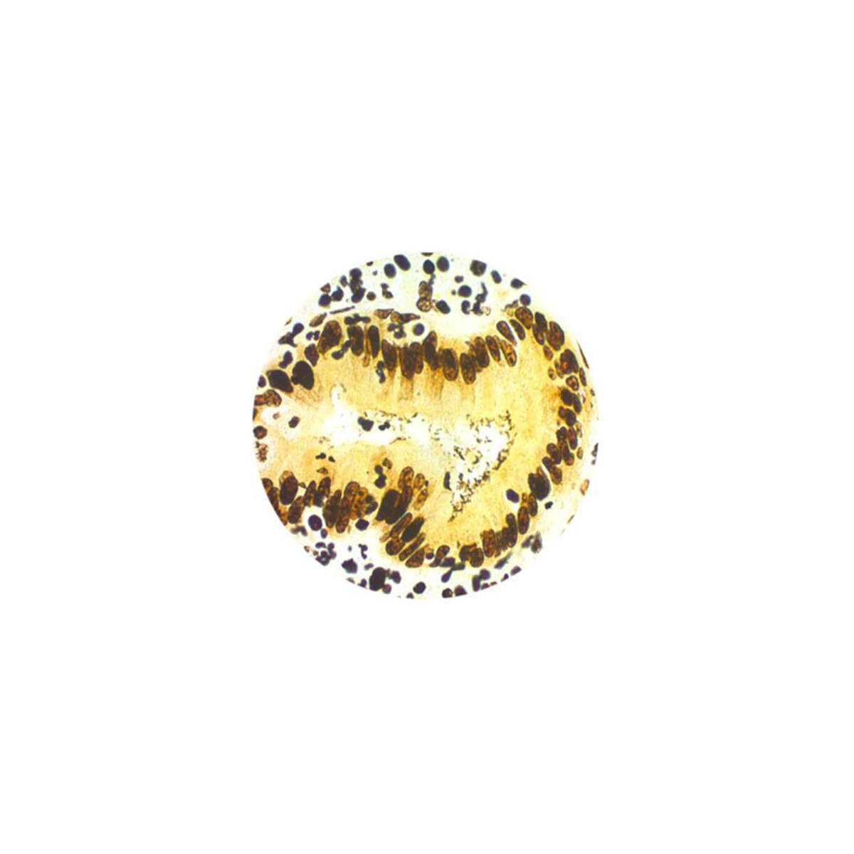Warthin-Starry Stain Kit